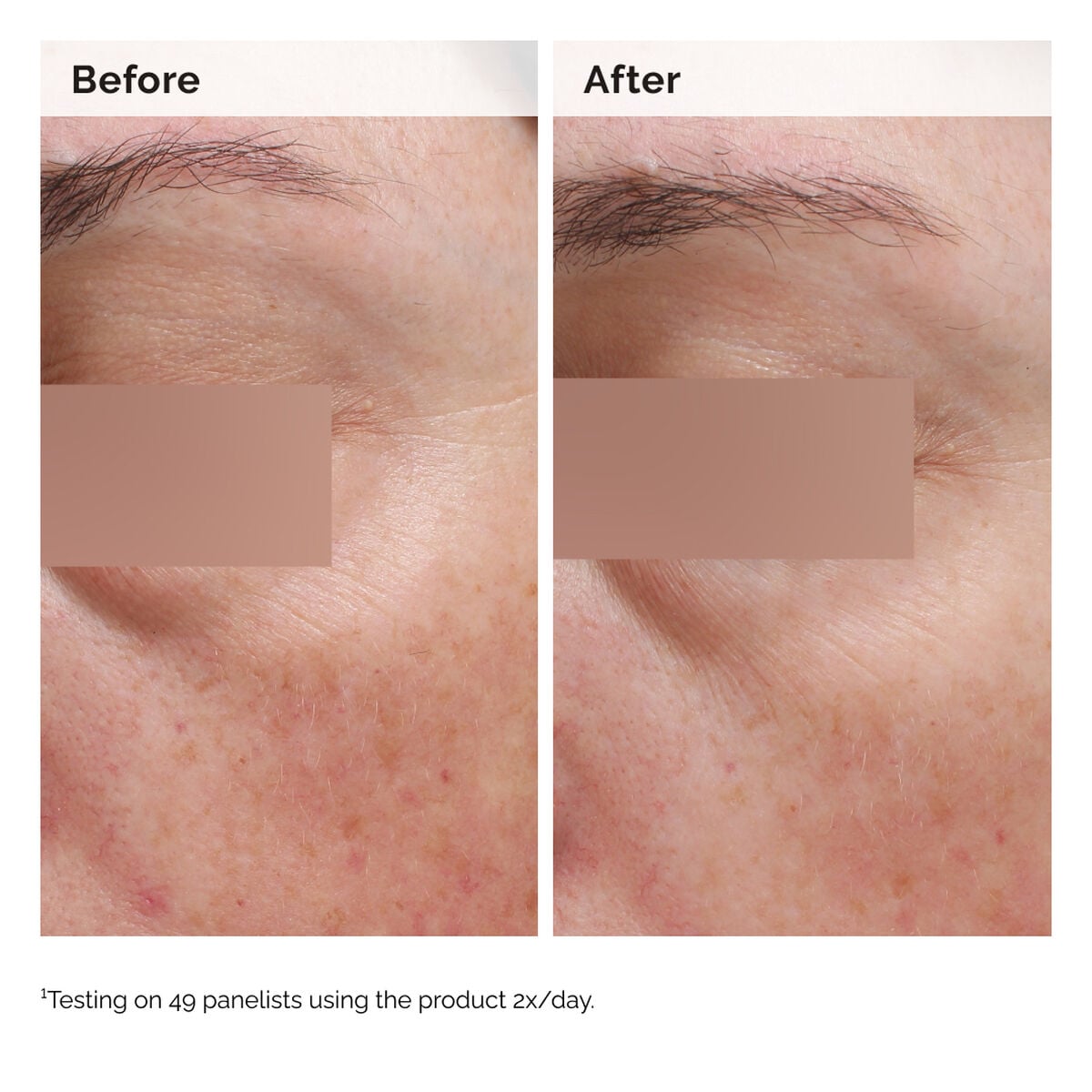 niacinamide-5-face-and-body-emulsion-p7 2024-08-23-ORD-Nia-5pct-Face-Body-B-A-Elasticity-Global-02-1x1.jpg