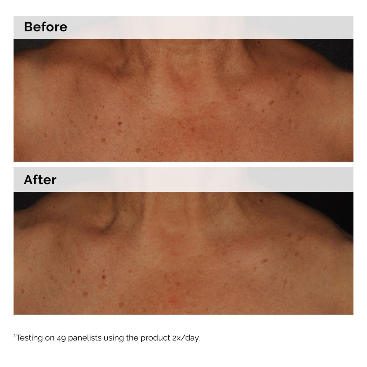 niacinamide-5-face-and-body-emulsion-p7 2024-08-23-ORD-Nia-5pct-Face-Body-B-A-Global-02-1x1.jpg