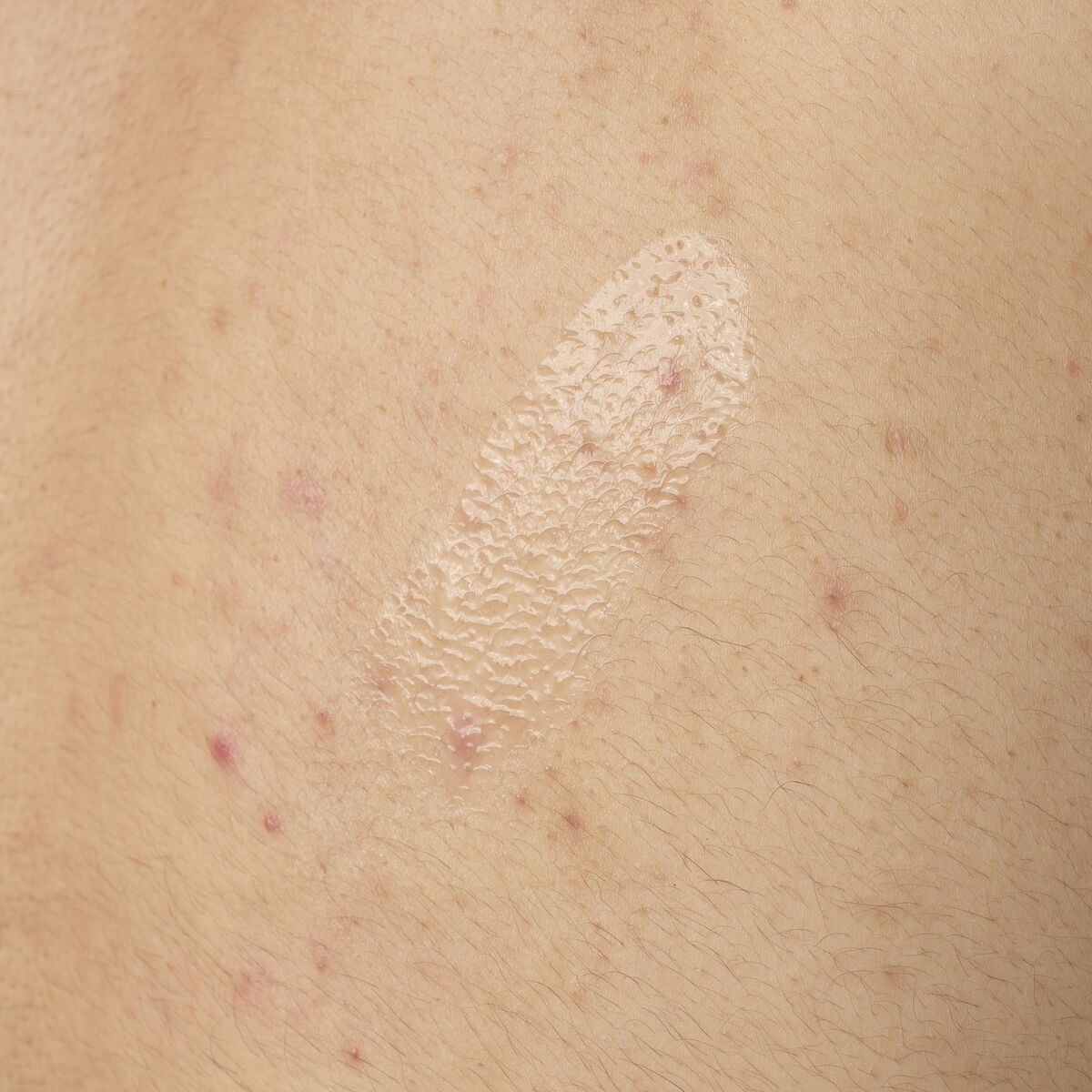salicylic-acid-0-5-body-serum-j4 ORD-salicylic-acid-05-body-240ml-application.jpg