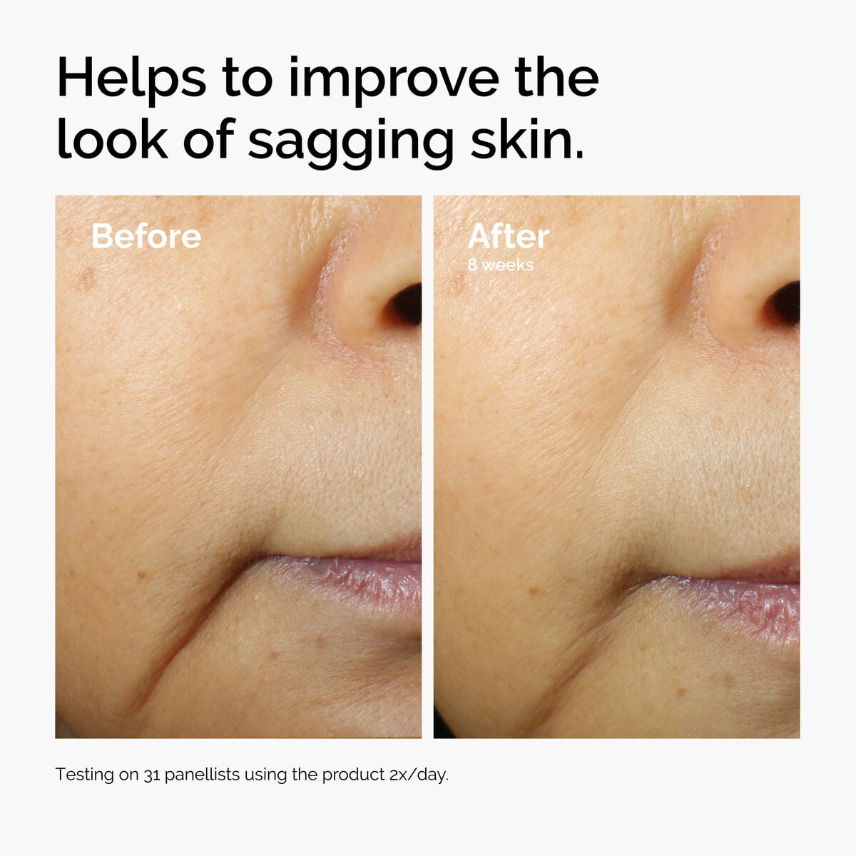 caffeine-3-escin-1-face-serum-f7 ord-caffeine-3pct-escin-1pct-face-serum-before-after-sagging.jpg