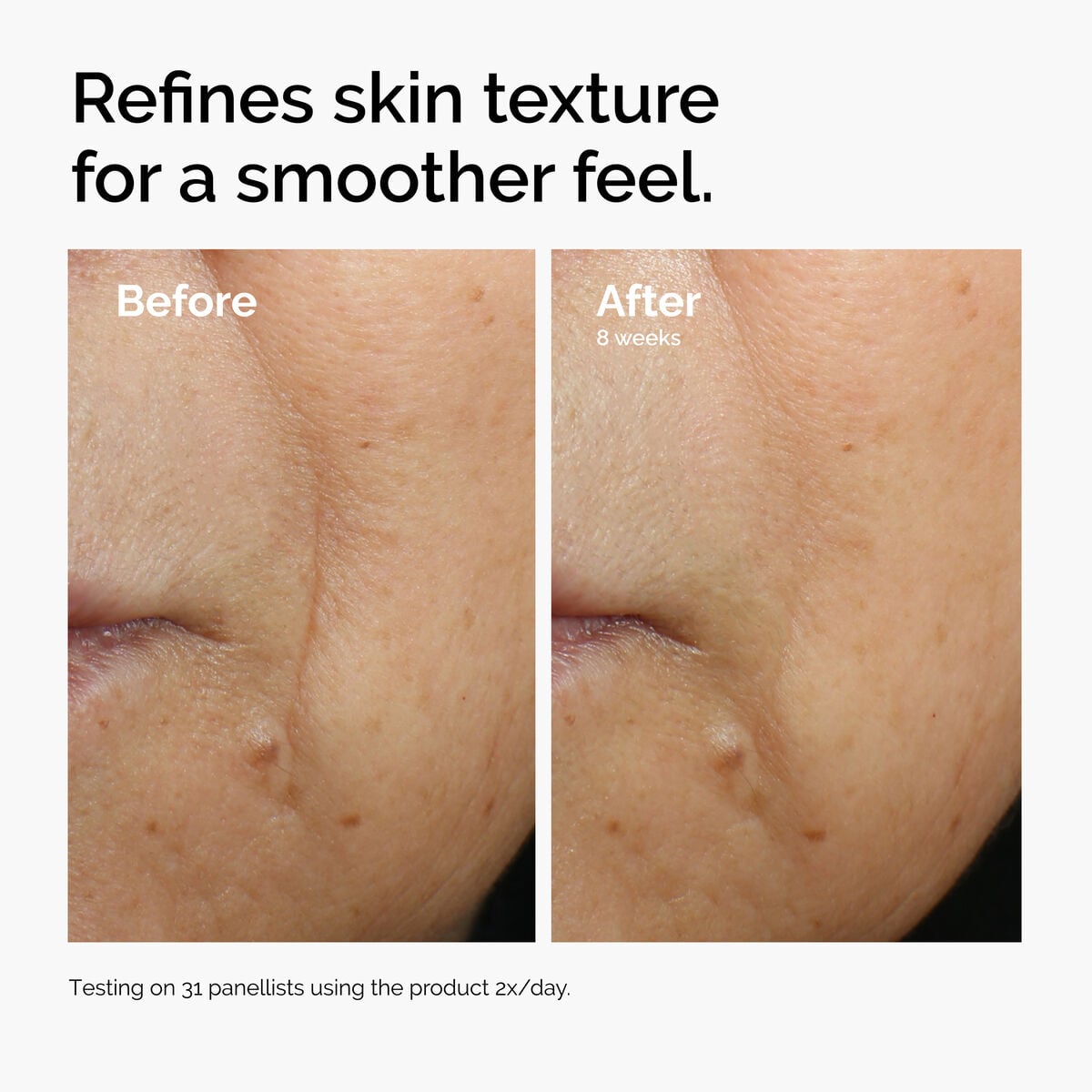 caffeine-3-escin-1-face-serum-f7 ord-caffeine-3pct-escin-1pct-face-serum-before-after-texture.jpg
