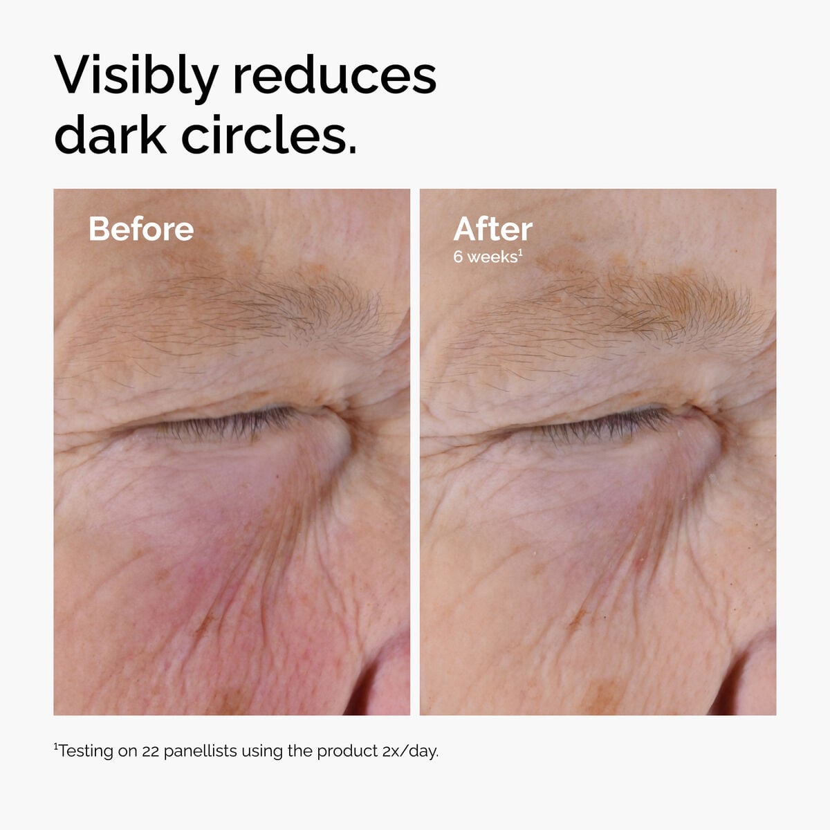 caffeine-solution-5-egcg-eye-serum-l3 ord-caffeine-solution-egcg-dark-circles-before-after.jpg