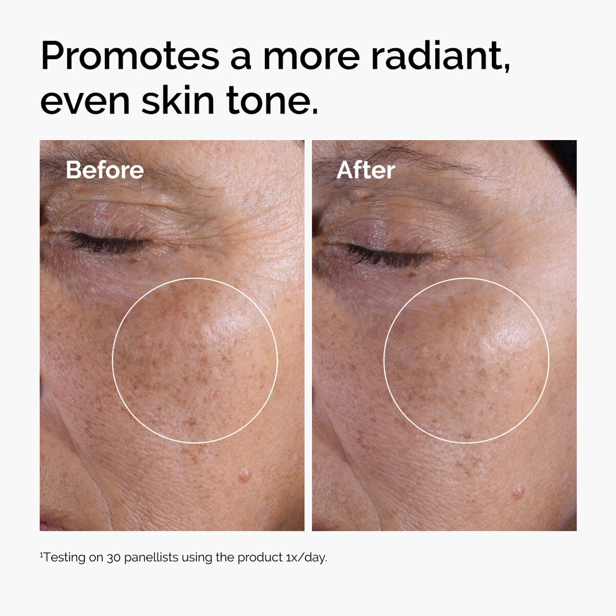 glycolic-acid-7-exfoliating-toner-c7 ord-glycolic-before-after-radiance.jpg