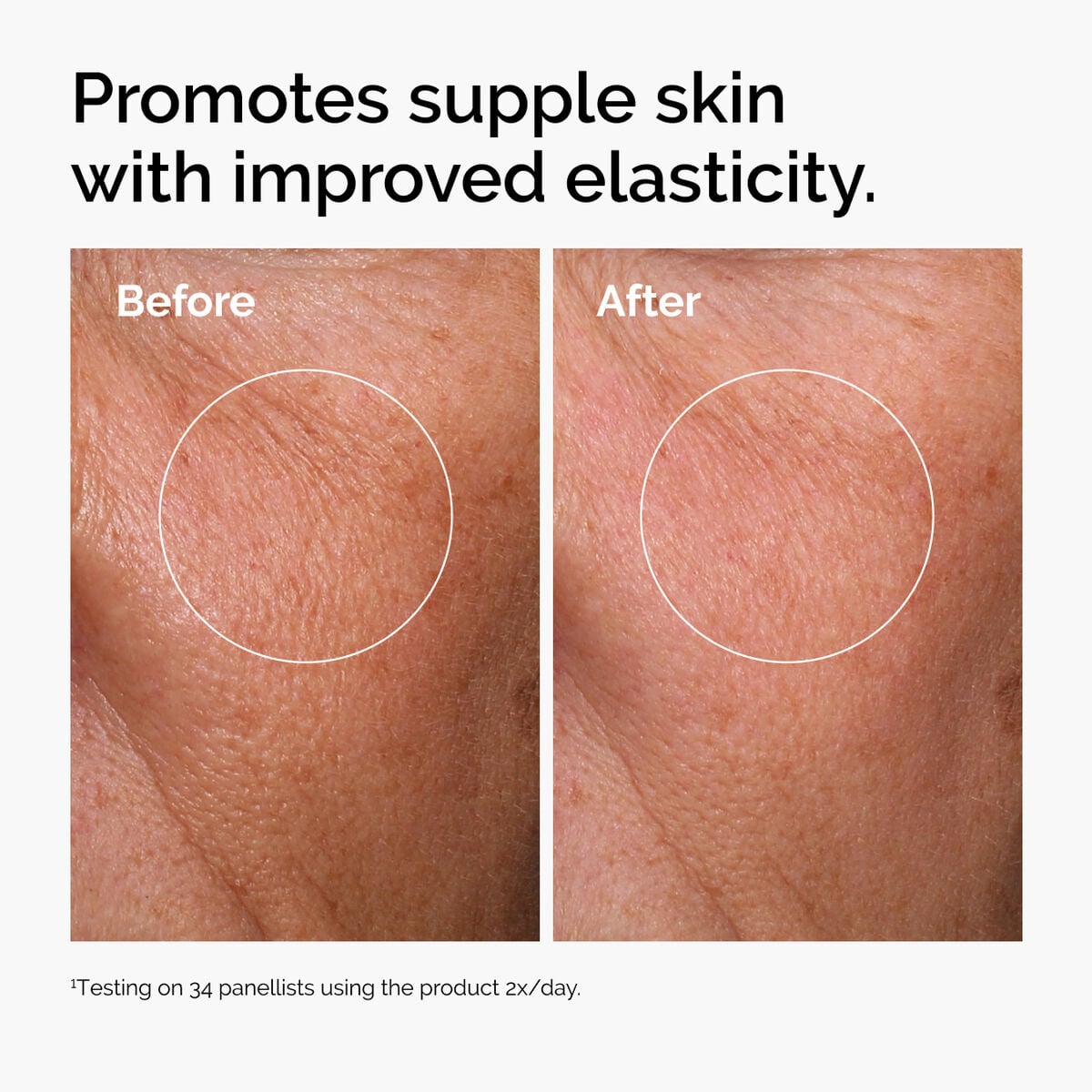 hyaluronic-acid-2-b5-with-ceramides-w4 ord-hyaluronic-acid-2pct-b5-hydrating-serum-before-after-elasticity.jpg
