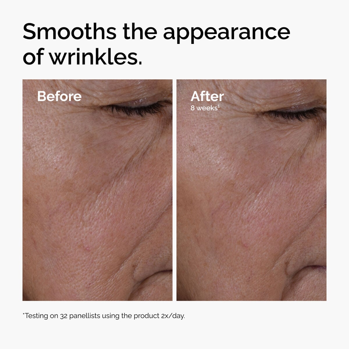multi-peptide-ha-serum-o3 ord-multi-peptide-ha-serum-wrinkles-before-after.jpg