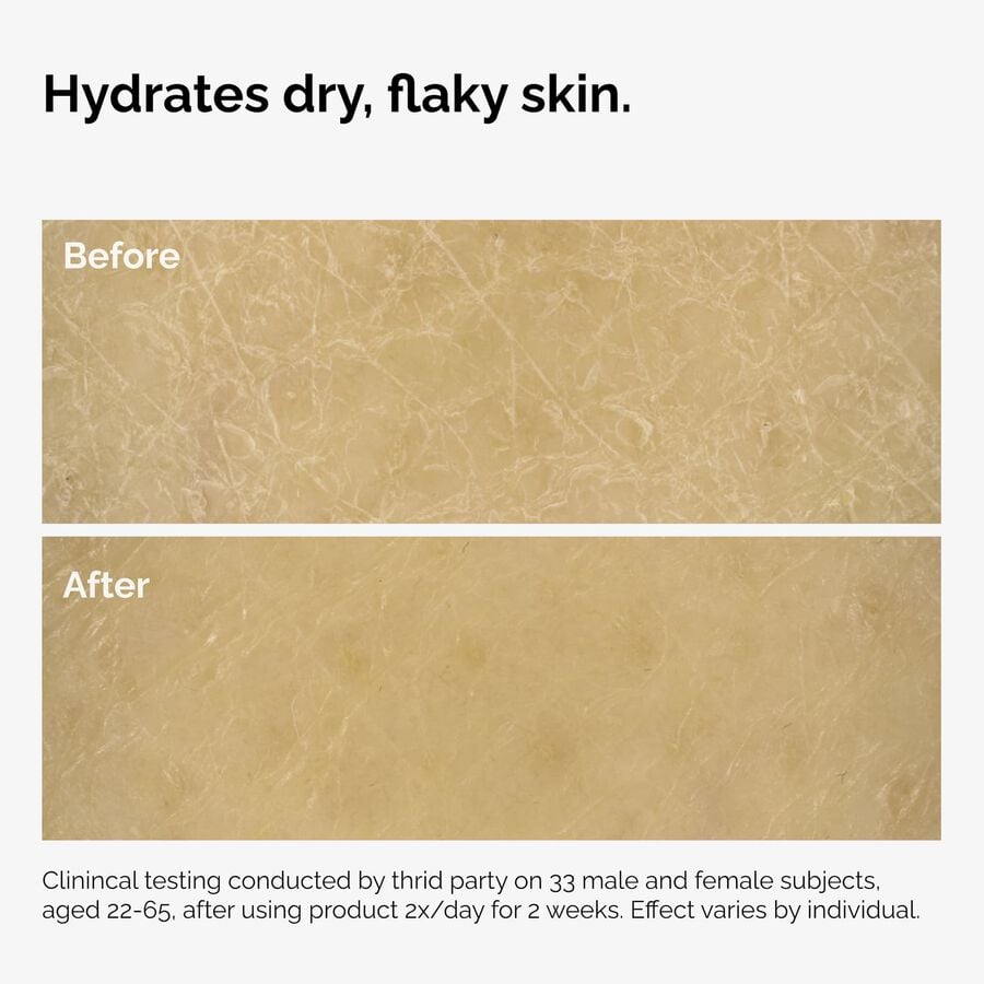 the-body-care-collection-g5 ord-natural-moisturizing-factors-inulin-body-before-after-graphic-02.jpg
