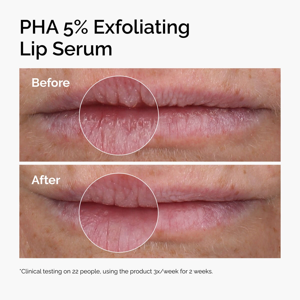 pha-5-exfoliating-lip-serum-s0 ord-pha-5pct-lip-exfoliating-serum-before-after.jpg